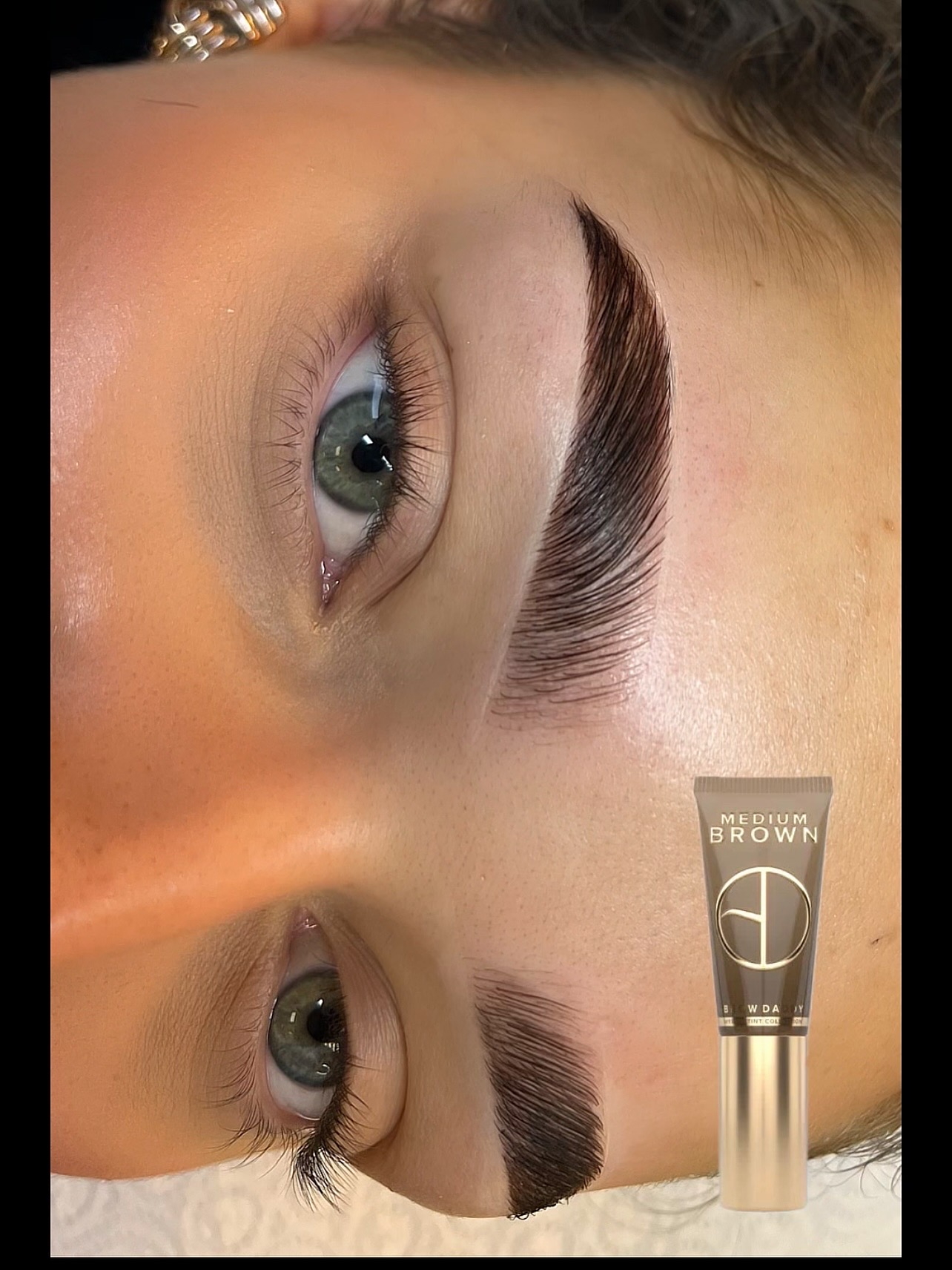 Browlift